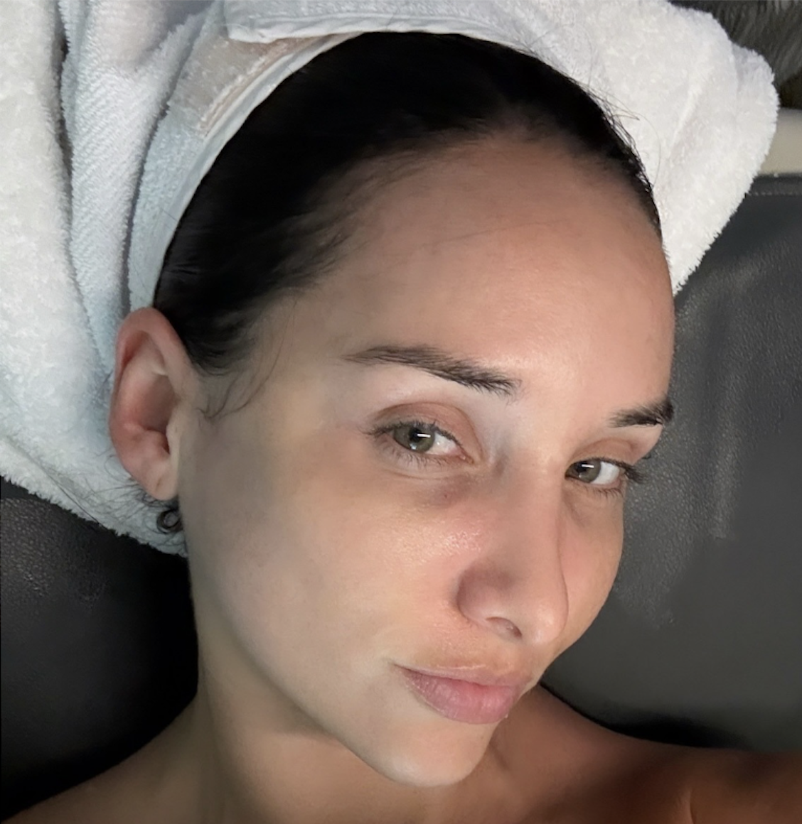 After, clear skin